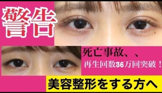 【警告】美容整形を真剣に考えている方へ。再生回数35万突破！の警告集の続きを。