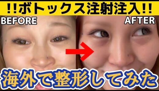 海外美容整形！ドイツでボトックス注射！INデュッセルドルフ