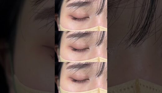 【二重整形】可愛いすぎるので最後まで見て！　#shorts