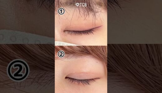 【美容整形】目頭切開しているのはどっち？#shorts