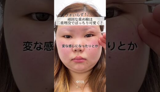 【二重整形】頑固な重め瞼二重幅デザイン解説👀❤️#shorts