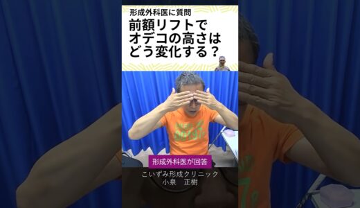 美容整形　フェイスリフト／前額リフトの質問