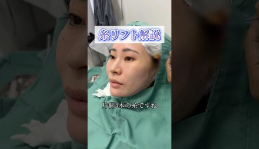 糸リフトの基本を解説！ #糸リフト #美容整形 #shorts