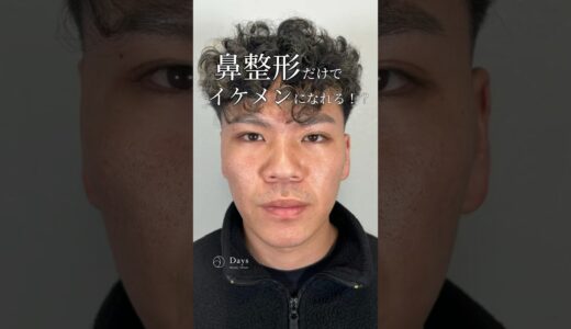 【鼻整形】鼻の形で全顔の印象が変わる！#shorts