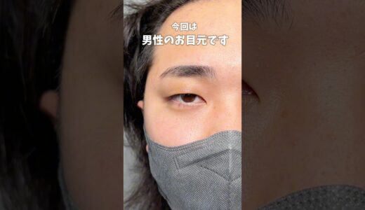 【二重整形】かっこよくなりすぎて衝撃!!男性の二重整形の仕上がりは…？ #美容 #高須クリニック#二重整形 #二重埋没 #shorts