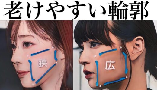お冬子とお広瀬なら輪郭三点の頬面積が狭いお冬子の方が将来土砂崩れしやすいのはマジ〜表ハムラ法、切開リフト