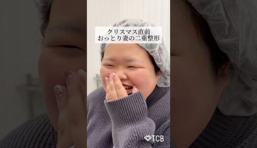 【二重整形】クリスマス直前！おっとり妻の二重整形 #shorts