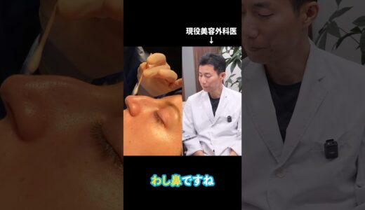 この方はどんな鼻整形を受けたと思う？ #鼻整形