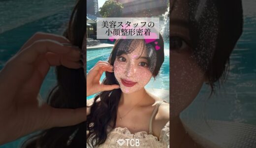 【糸リフト】美容スタッフの小顔整形に密着しました🤲#shorts