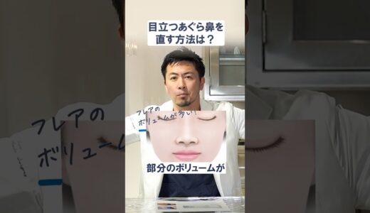 目立つあぐら鼻を治す方法は？#鼻整形#整形 #美容整形#美容クリニック#プロテーゼ#鼻中隔延長 #美容 #あぐら鼻