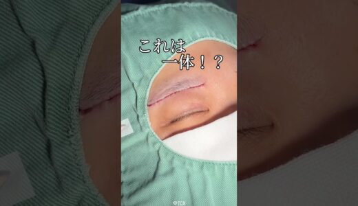 【美容整形】これは一体！？#shorts