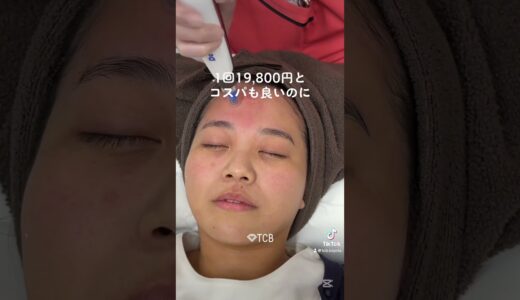 #ダーマペン#美容整形#整形#tcb