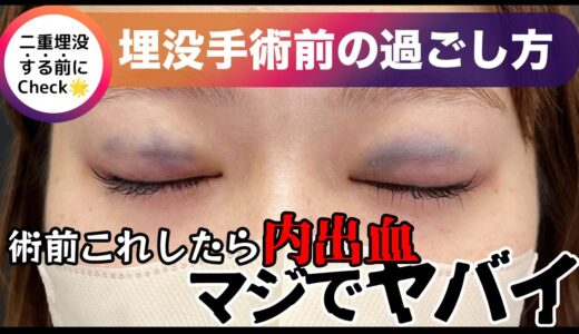 【二重埋没法】ダウンタイムを最小限に抑えるために気をつけること