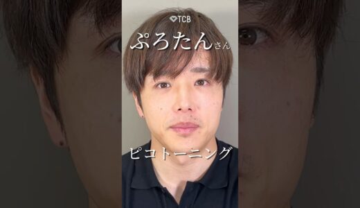 【美容整形】ぷろたんさんのピコトーニング　#shorts