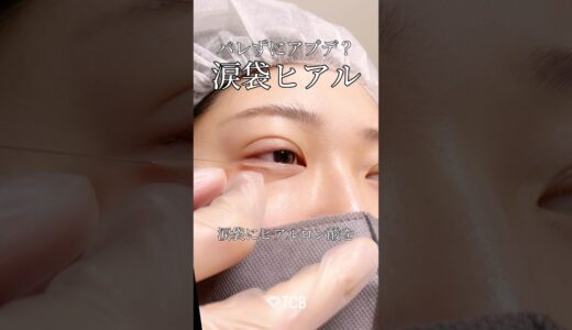 【涙袋ヒアルロン酸】バレずにアップデート？#shorts