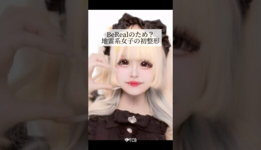 【二重整形】BeRealのため？地雷系女子の初整形 #shorts