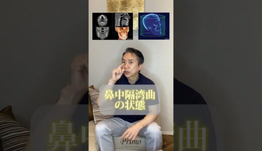美容整形　カウンセリング　鼻整形　#shorts