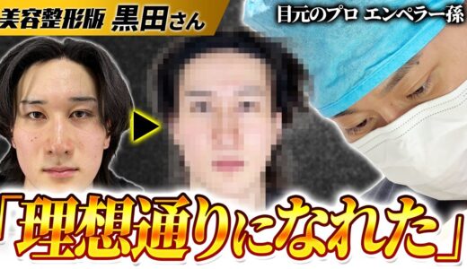 【美容整形版令和の虎】女性用風〇でセラピストとして働く黒田さんの目元整形オペに密着