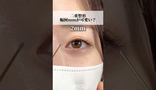 【二重整形】幅何ミリが可愛い？#shorts