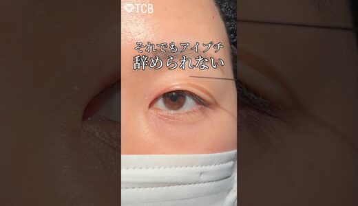 【二重整形】それでもアイプチ辞められない #shorts