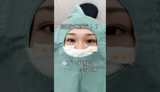 【クマ取り】プレ花嫁の美容整形#shorts