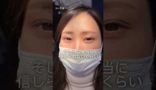 え、これどうしたの？ #shorts