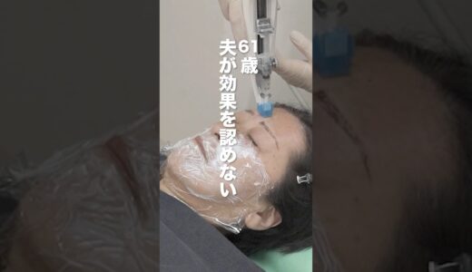 「整形は嫌」ダイエットでできたシワは消えるのか？ #肌の再生医療  #美容整形 #エイジングケア