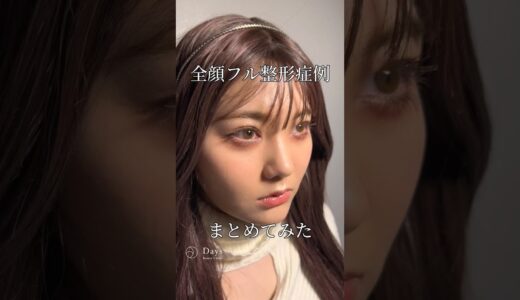 【全顔フル整形】全顔整形症例まとめてみた#shorts