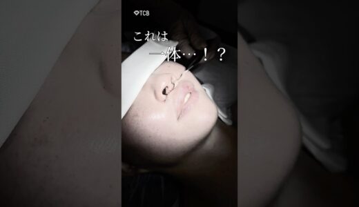 【美容整形】これは一体…！？　#shorts