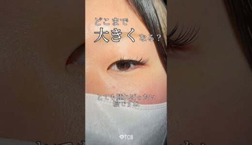 【二重整形】どこまで大きくなる？👀#shorts