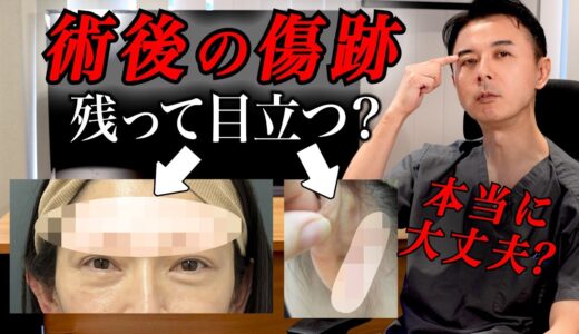 【ヤバイ？】切開したら傷は目立つの？【美容整形の傷跡】