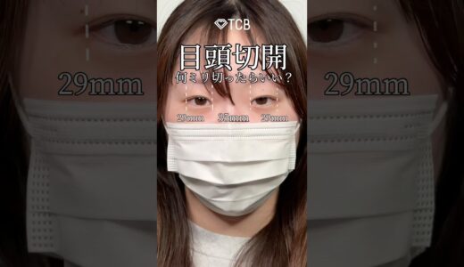 【二重整形】目頭切開何ミリがベスト？ #shorts