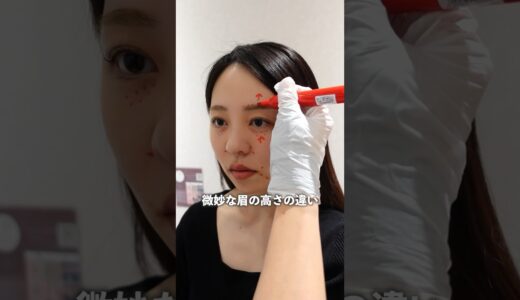 【前編】大本命「サーマジェン」レポ#サーマジェン#ハイフ#美容医療#たるみ治療#シワ改善#HIFU#美容クリニック#アラサー#30代#エイジング#エイジングケア