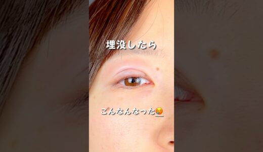二重整形で垢抜け❤️ #shorts #下川洋輝 #美容 #美容整形 #垢抜け