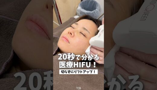 【美容整形】20秒で分かる医療HIFU✨#shorts