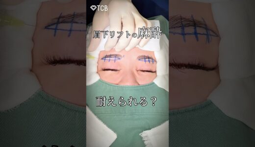 【眉下リフト】麻酔、耐えられる？#shorts