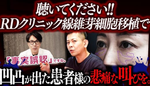 【再生美容医療終了】RDクリニックの再生医療による目の下凹凸の患者様をシンシアが修正。凹凸になった理由を立位3DCTで完全解説します。【北條先生】