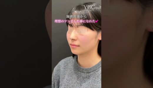 【鼻整形】念願の鼻整形したら･･･#shorts
