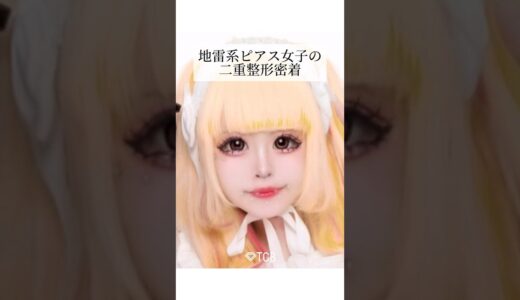 【二重整形】地雷系ピアス女子の二重整形密着 #shorts