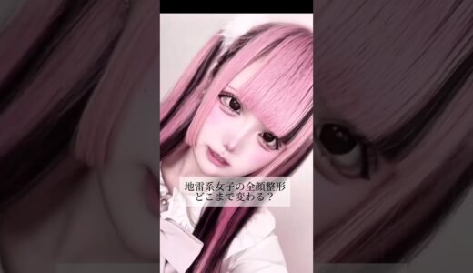 【全顔整形】#shorts 地雷系女子どこまで変わる？