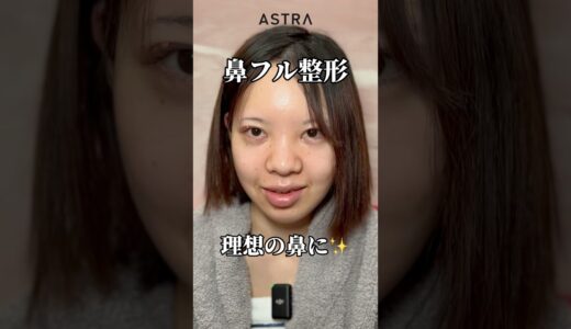 理想の鼻になれる😳♥️#astrabeautyclinic  #アストラビューティークリニック #塩満恵子 #鼻整形 #美容整形 #忘れ鼻