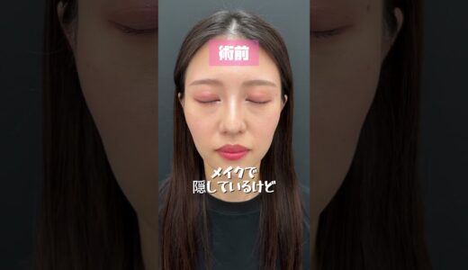 満足度100%私の美容整形✨🫧