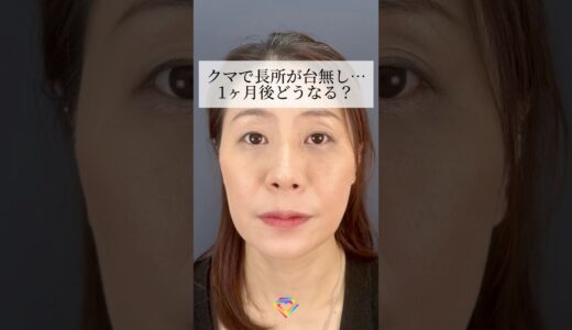 【クマ取り】長所が台無し…どうなる？#shorts