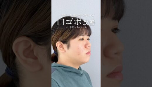 口ゴボ改善！上下セットバック #美容整形 #整形 #口ゴボ