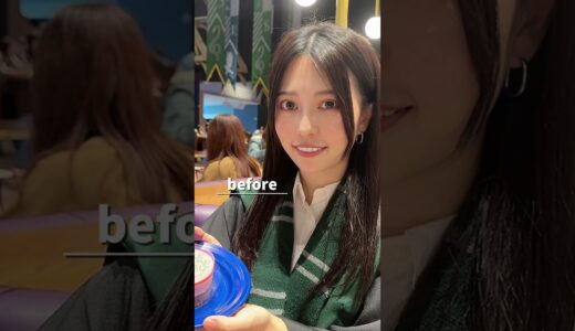 理想の自分になる為にやってよかった美容整形✨