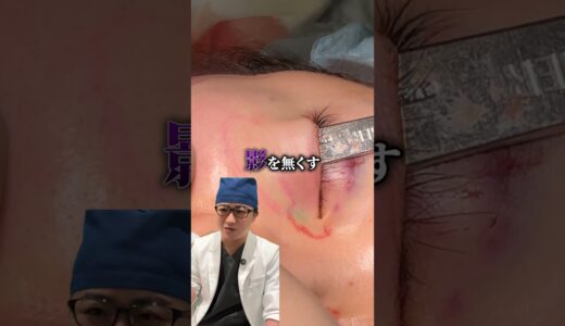 【整形】目の下グリグリ…これは何？ #shorts