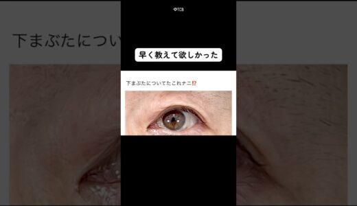 【美容整形】下まぶたについてるこれナニ⁉️#shorts
