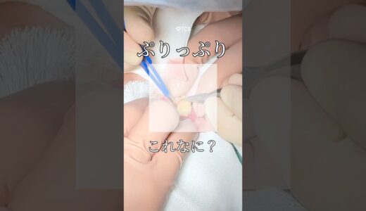 【クマ取り】ぷりっぷり これなに？ #shorts