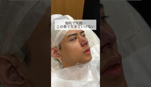 【鼻整形】他院で失敗…#shorts