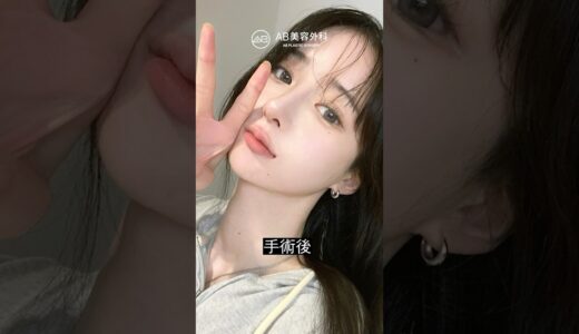目鼻輪郭整形の3点セット! 変化がすごすぎる | AB美容整形